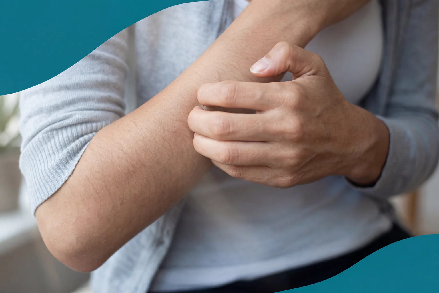Leva med psoriasis: 7 vardagstips när skoven styr
