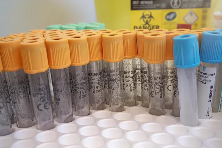 En närbild av flera medicinska provrör med orange och blå korkar, stående i ett vitt plastställ.